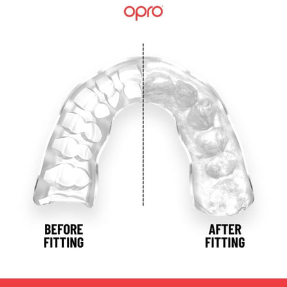OPRO Mouth Guard Japan Instant Custom Fit